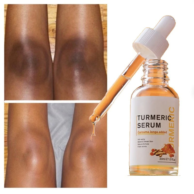 All-Natural Turmeric Serum for Glowing Skin – Perfect Beauty & Skincare Gift